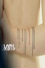 Scars